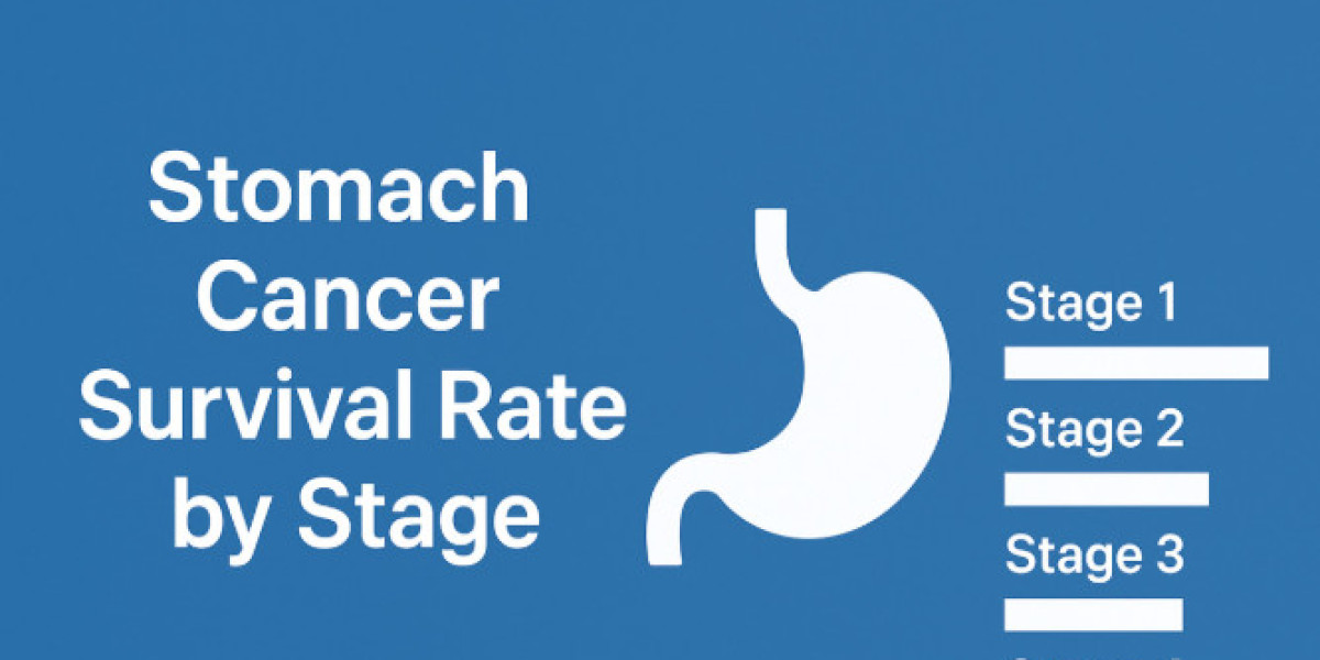 Stomach Cancer Survival Rate by Stage
