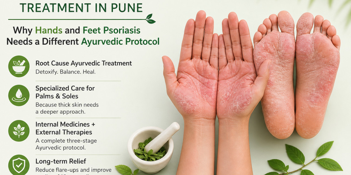 Palmar Psoriasis Treatment in Pune: Why Hands and Feet Psoriasis Needs a Different Ayurvedic Protocol