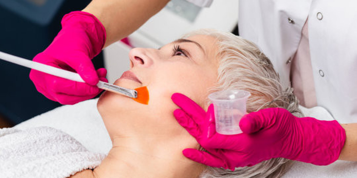 Chemical Peels in Islamabad for Uneven Skin Tone