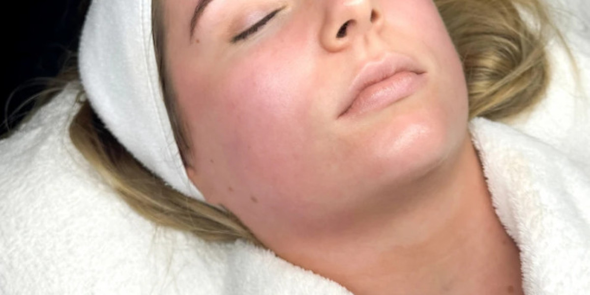 BioRePeel In Manchester – Glow Without Downtime
