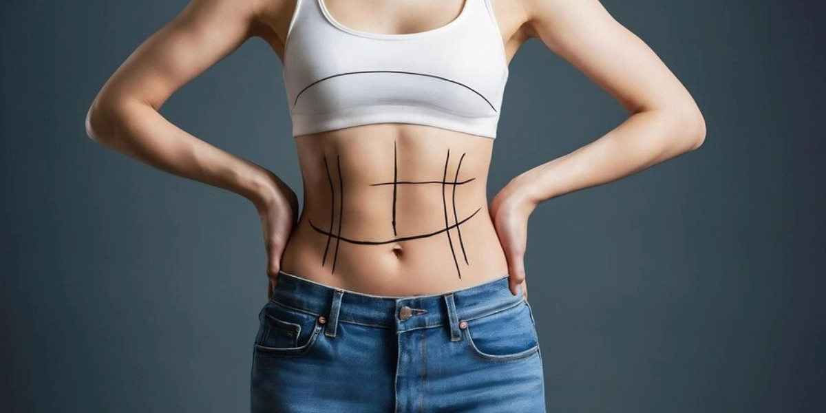 Understanding the Recovery Process After a Tummy Tuck in Islamabad