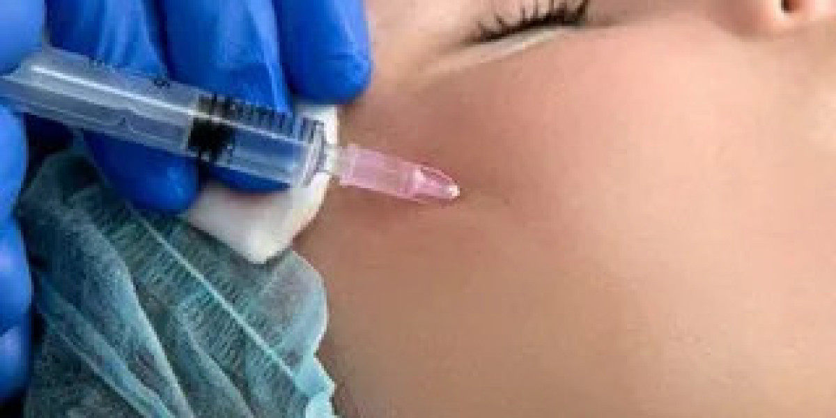 Mesotherapy in Islamabad – Complete Guide