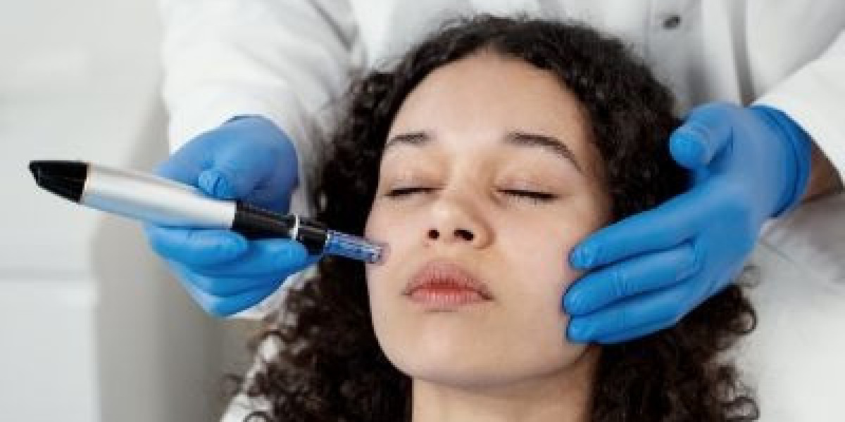 Microneedling in Islamabad – Complete Simple Guide for Skin Repair, Glow, and Natural Collagen Boost